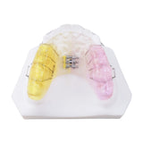 Dental Arch Expansion Appliance