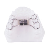 Rapid Palatal Expander